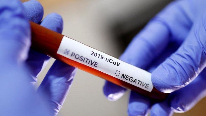 Azərbaycanda koronavirusa yoluxma faktı daha da aşağı düşdü