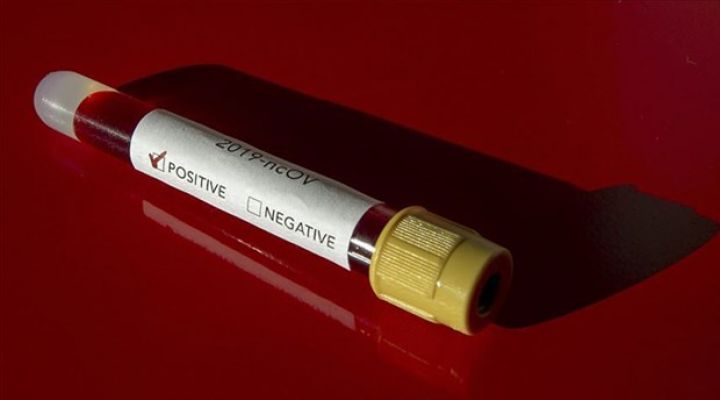 Azərbaycanda koronavirus ilə bağlı son vəziyyət açıqlandı