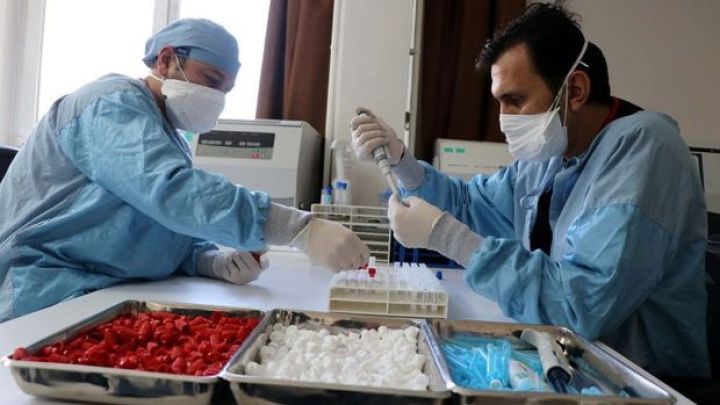 Türkiyə peyvəndinin adı məlum oldu: TURKOVAC