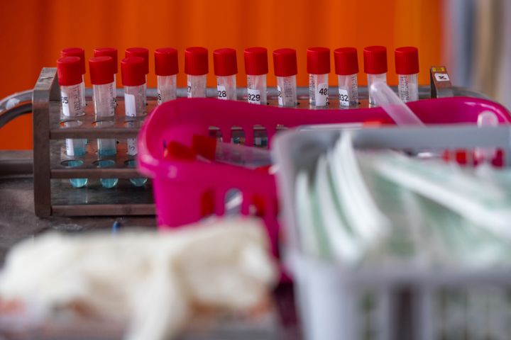 Azərbaycanda koronavirus ilə bağlı son vəziyyət açıqlandı