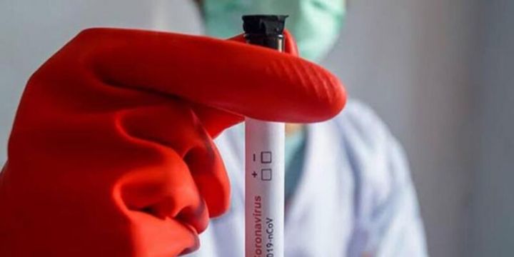 Azərbaycanda koronavirus ilə bağlı son vəziyyət açıqlandı